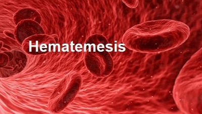 ჰემატემეზი (სისხლიანი ღებინება)